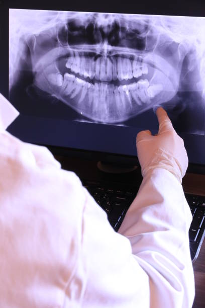 Best Dentist for Tooth Abscess  in Hinton, WV